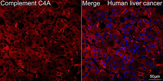 Complement C4a Antibody (4C3F2)