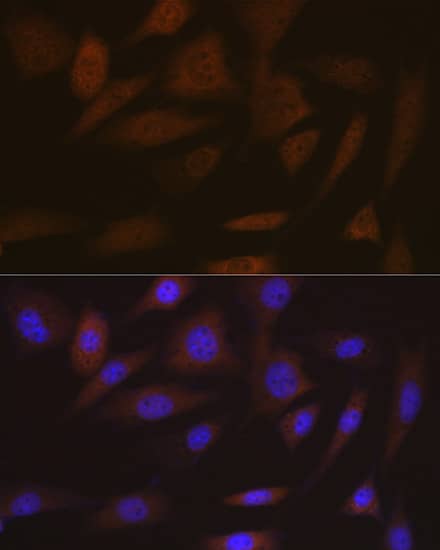 SMC4 Antibody (9Z8S3)