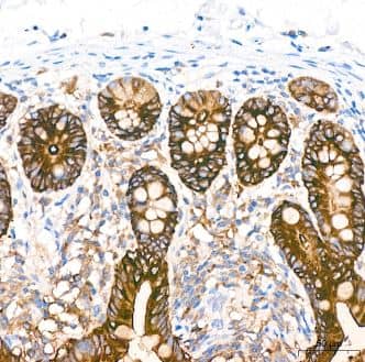 COX-2 Antibody (2V7G8) - BSA Free