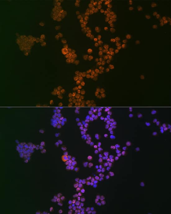 Ikaros/IKZF1 Antibody (4S10I3)