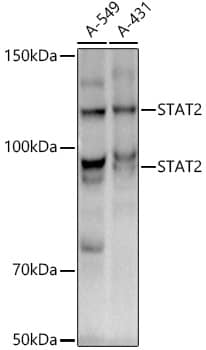 STAT2 Antibody (4A5P8)