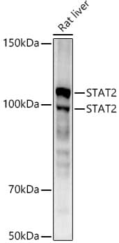 STAT2 Antibody (4A5P8)
