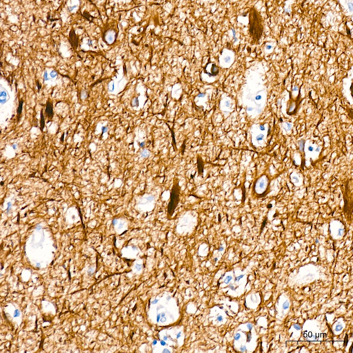 alpha-Internexin Antibody (5E5Z3)