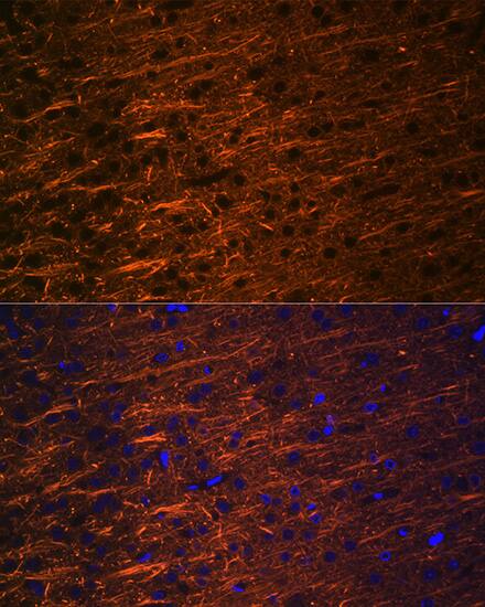 alpha-Internexin Antibody (5E5Z3)