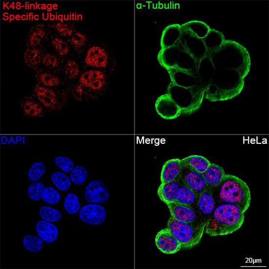 Poly-Ubiquitin Antibody (5Y8J0) - K48 Linkage