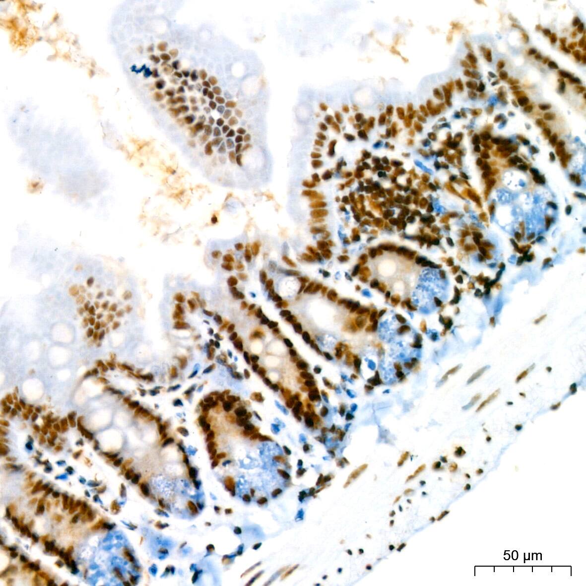 RBBP4/RbAp48 Antibody (0D1X1)