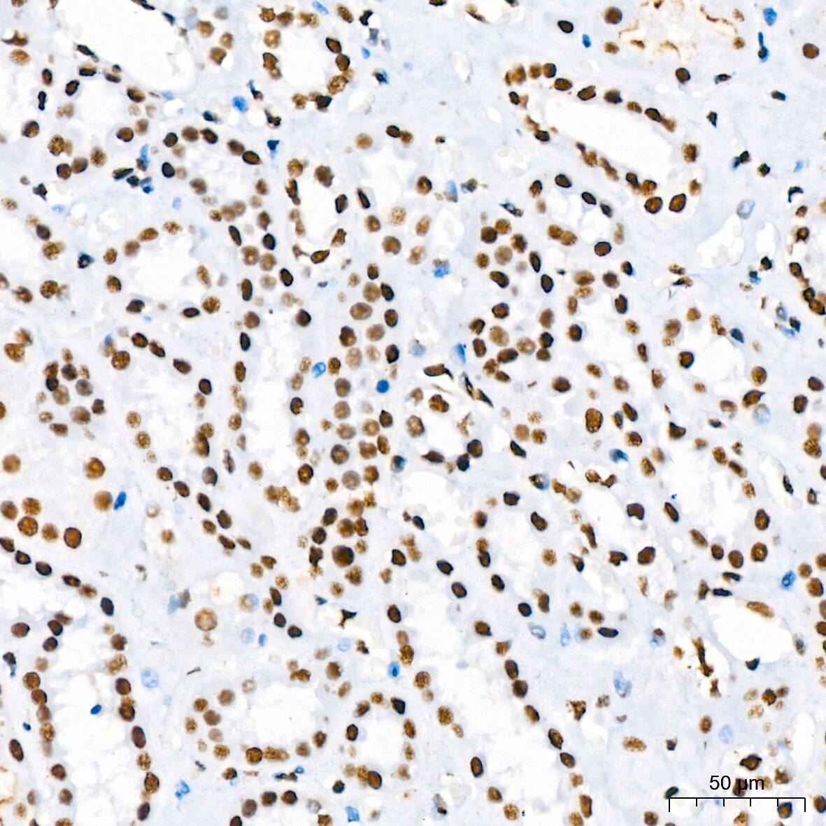RBBP4/RbAp48 Antibody (0D1X1)