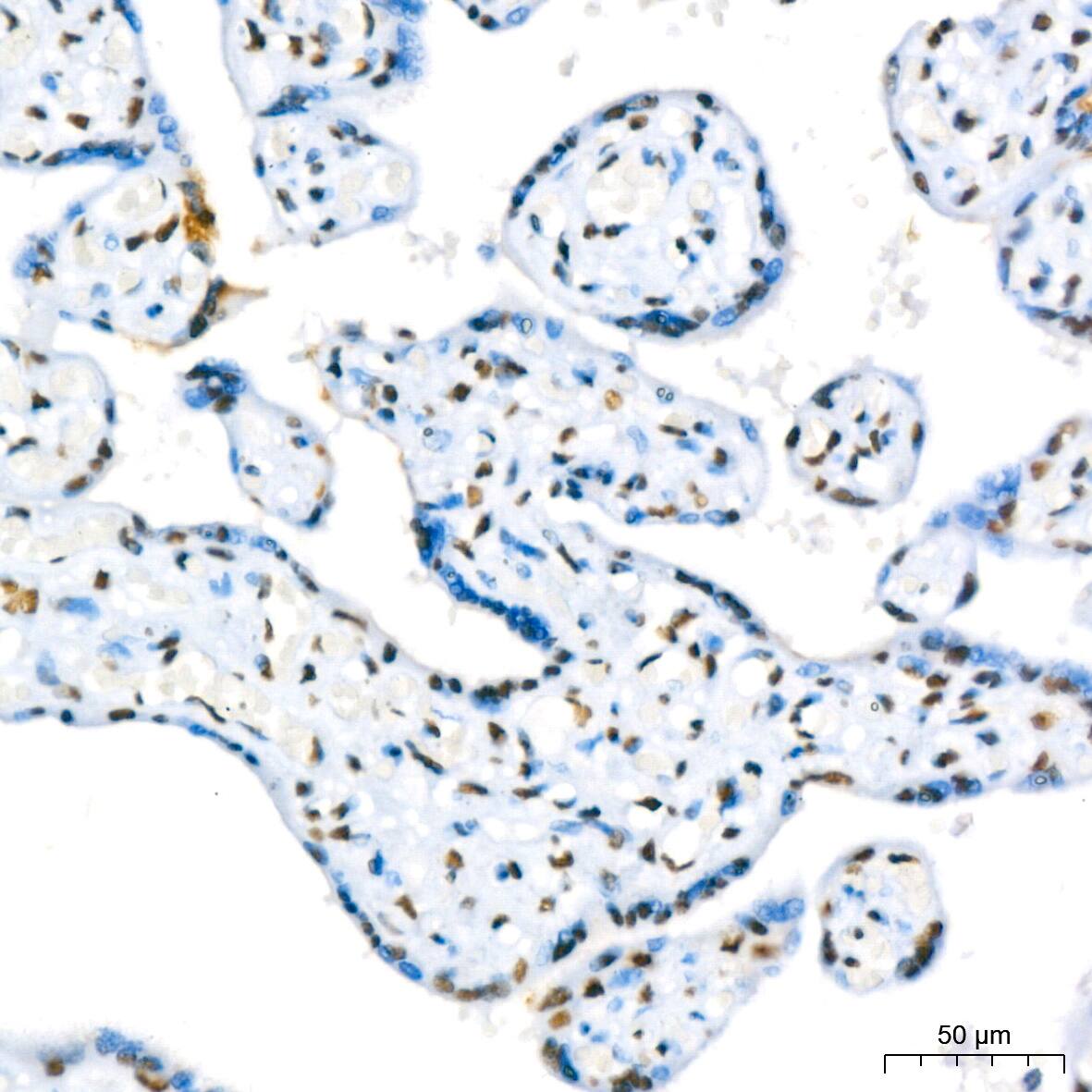 RBBP4/RbAp48 Antibody (0D1X1)