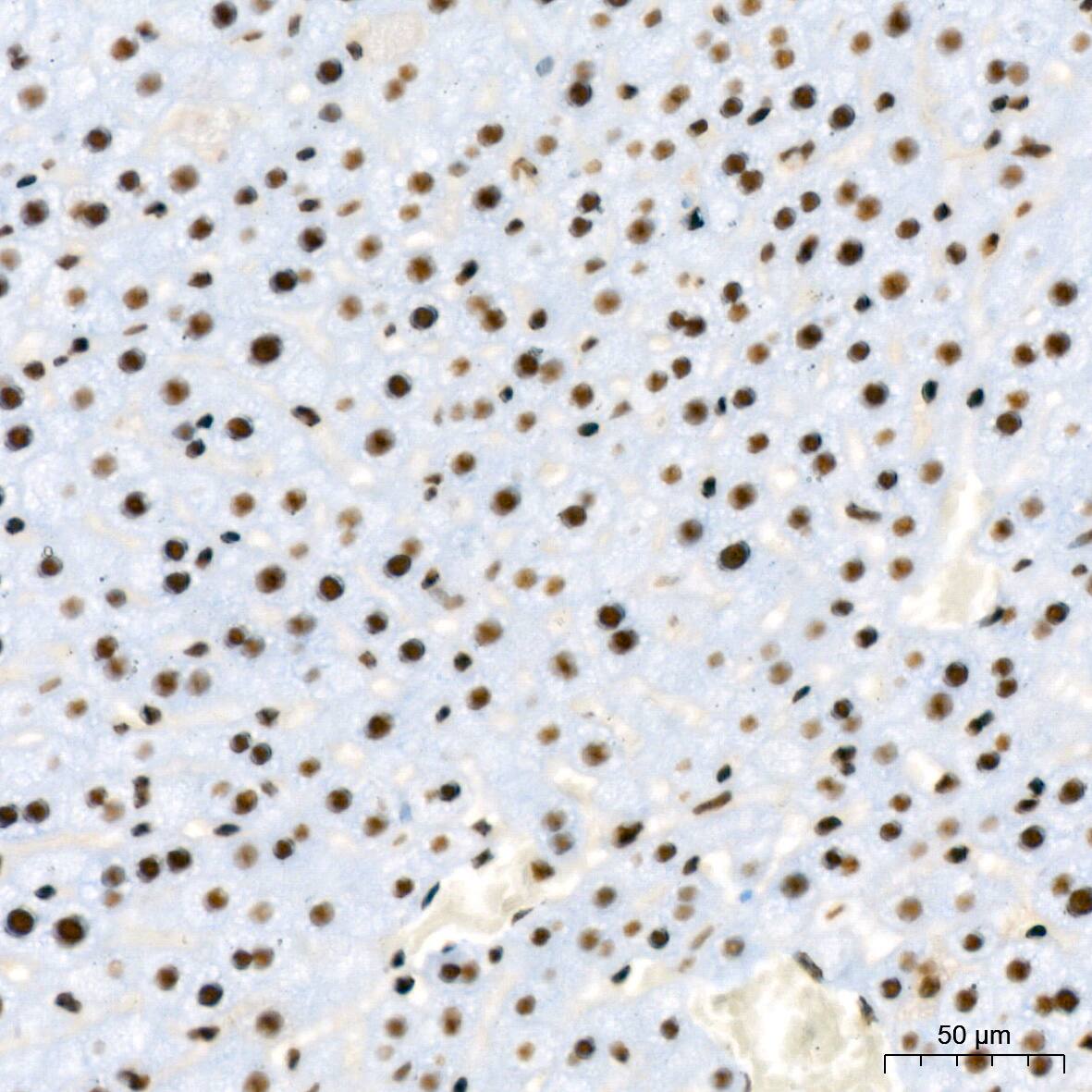 RBBP4/RbAp48 Antibody (0D1X1)