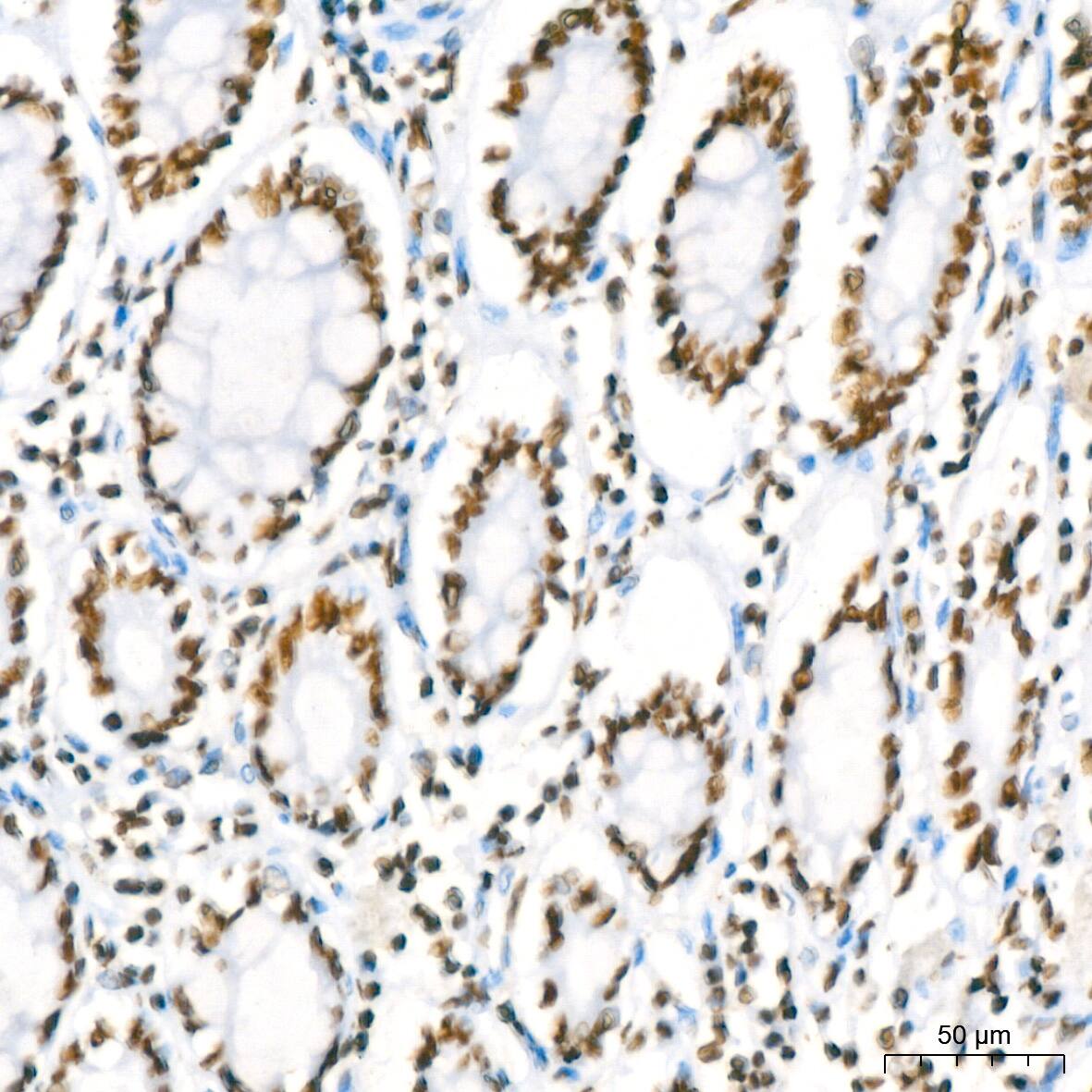RBBP4/RbAp48 Antibody (0D1X1)