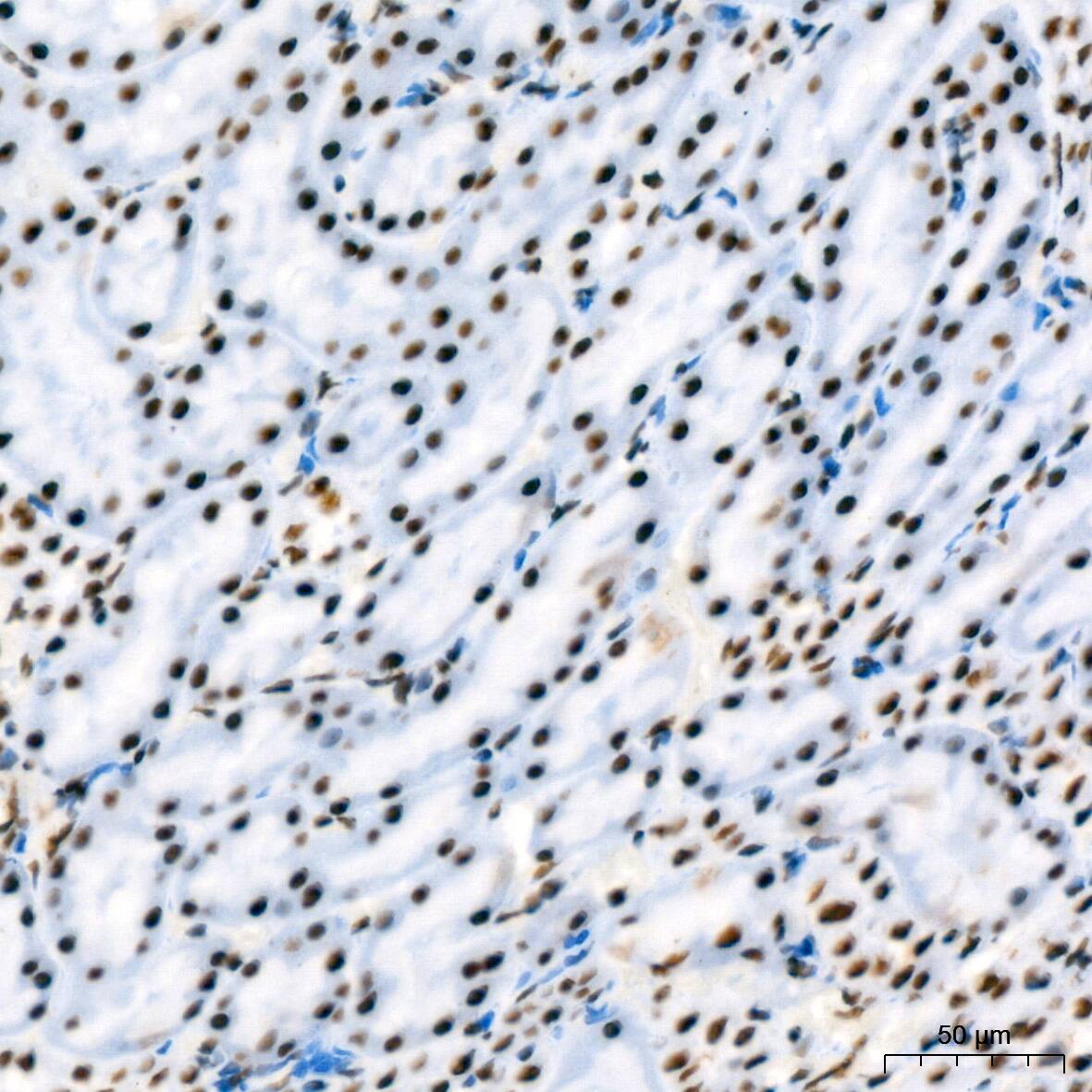 RBBP4/RbAp48 Antibody (0D1X1)