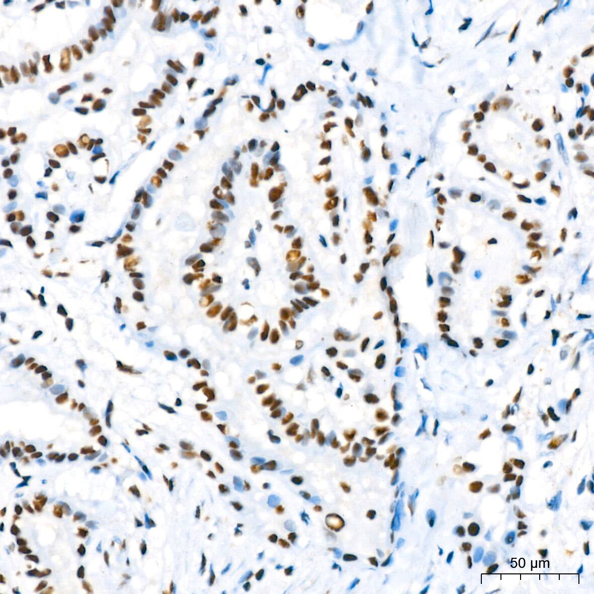 RBBP4/RbAp48 Antibody (0D1X1)