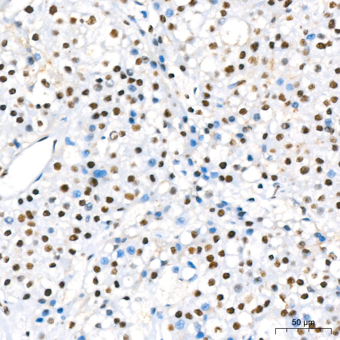 RBBP4/RbAp48 Antibody (0D1X1)