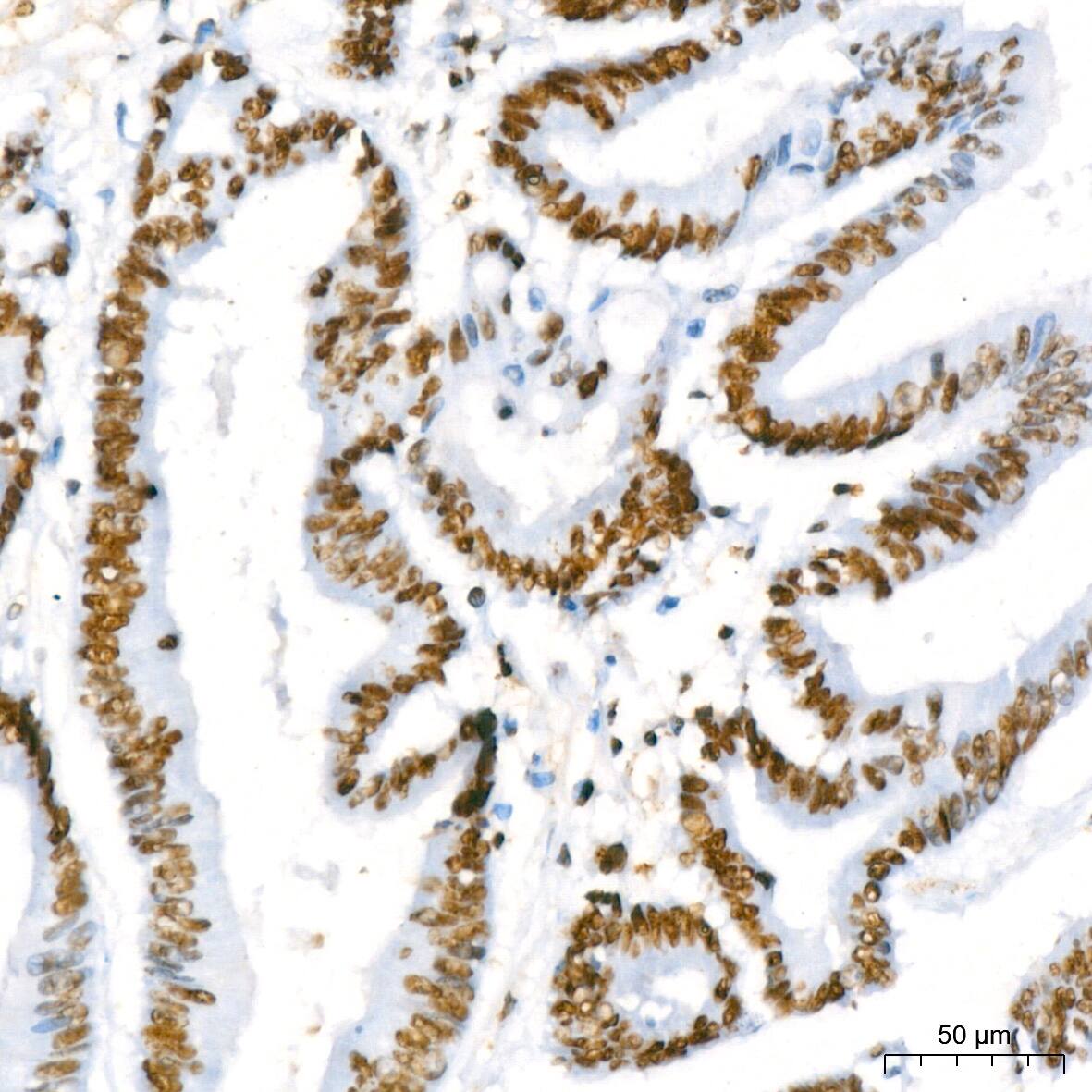 RBBP4/RbAp48 Antibody (0D1X1)