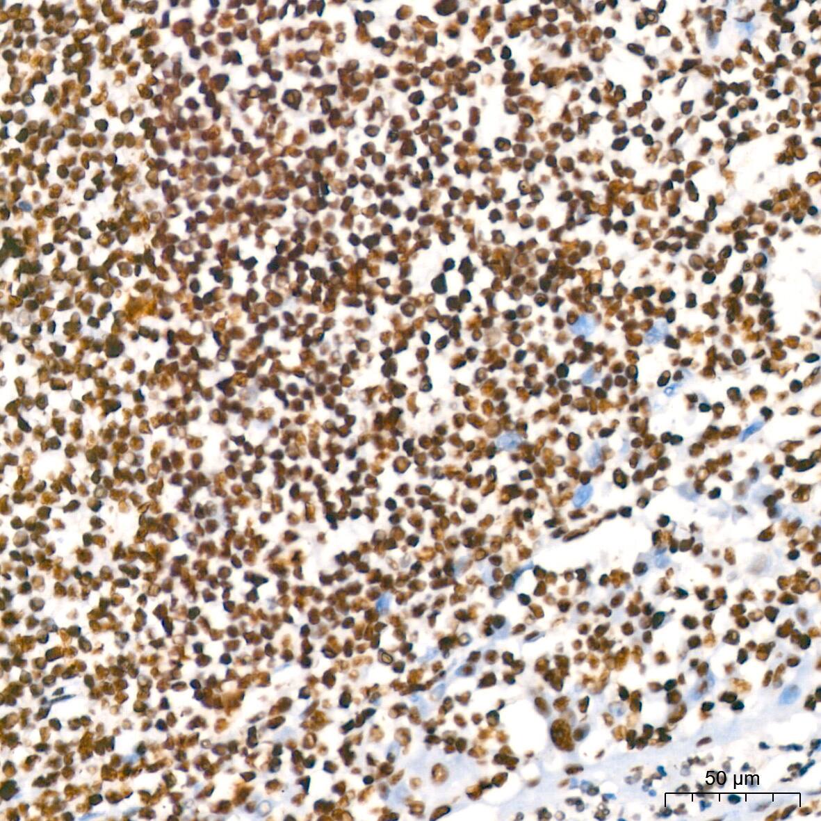 RBBP4/RbAp48 Antibody (0D1X1)