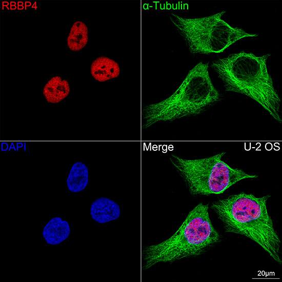 RBBP4/RbAp48 Antibody (0D1X1)