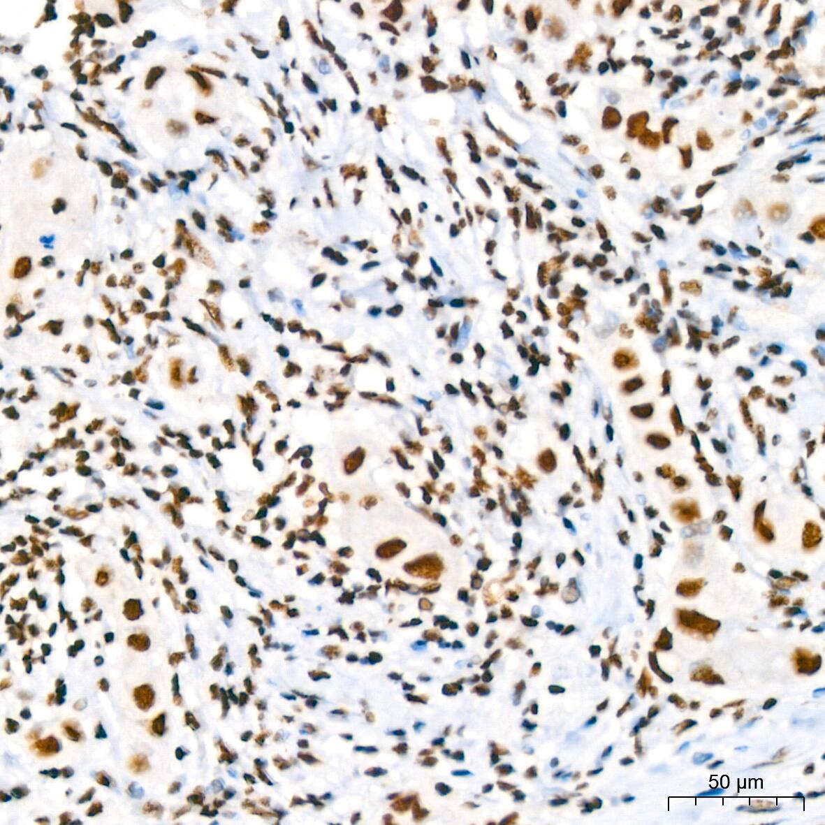RBBP4/RbAp48 Antibody (0D1X1)