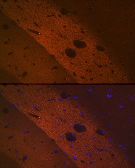 mGluR2 Antibody (0U6B5)