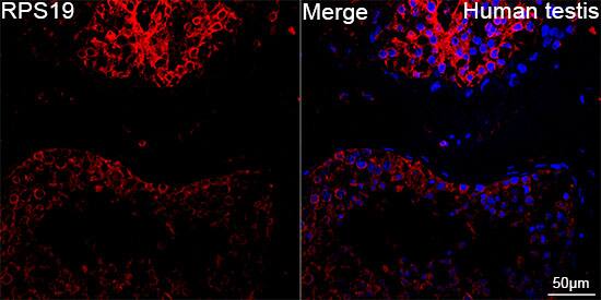 RPS19 Antibody (4V3S7)