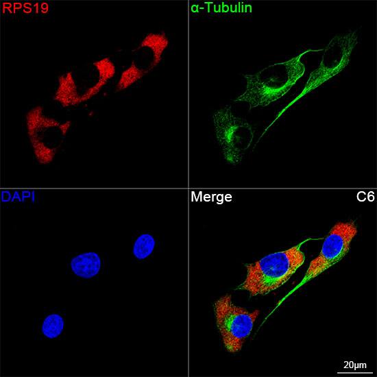RPS19 Antibody (4V3S7)