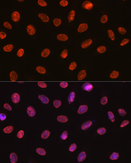U1A Antibody (8I3P5)