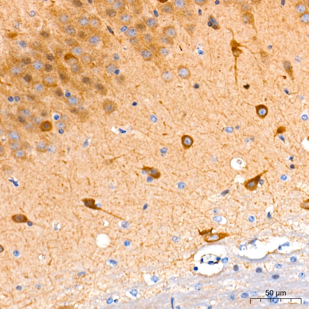 Guanylyl Cyclase beta 1 Antibody (5O8D9)