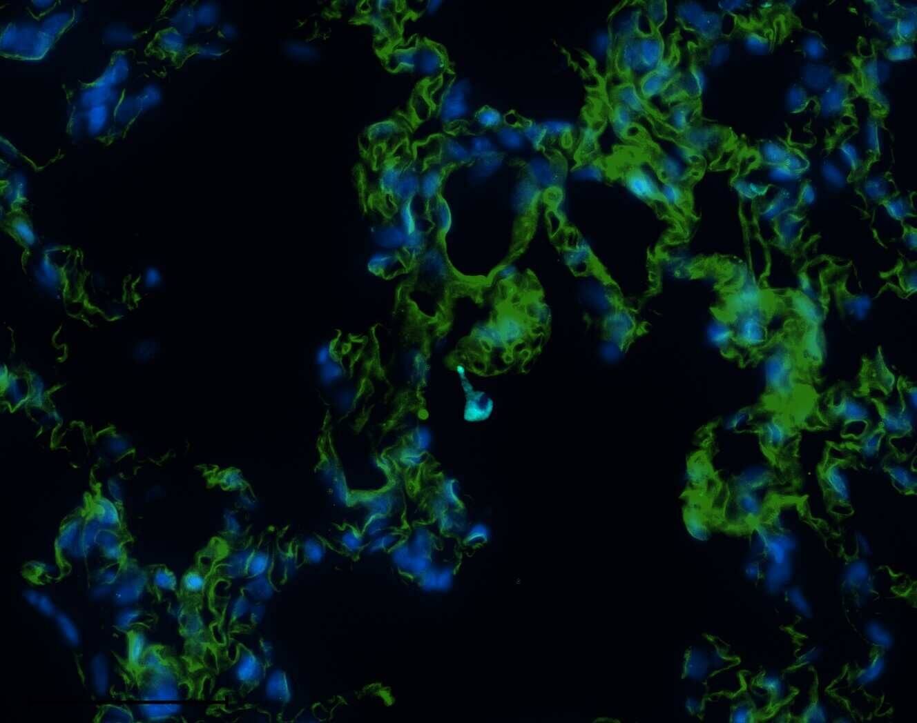 Guanylyl Cyclase beta 1 Antibody (5O8D9)