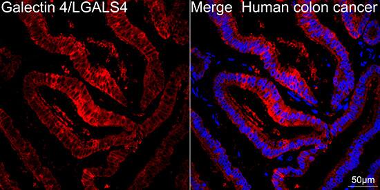 Galectin-4 Antibody (9Z2B5)