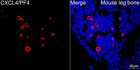 CXCL4/PF4 Antibody (6Q10H2)