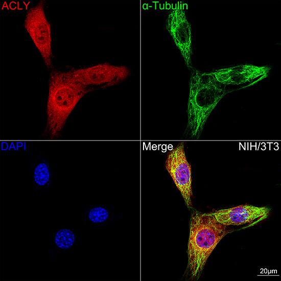 ATP Citrate Lyase Antibody (8A0V0)