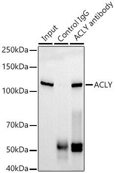 ATP Citrate Lyase Antibody (8A0V0)