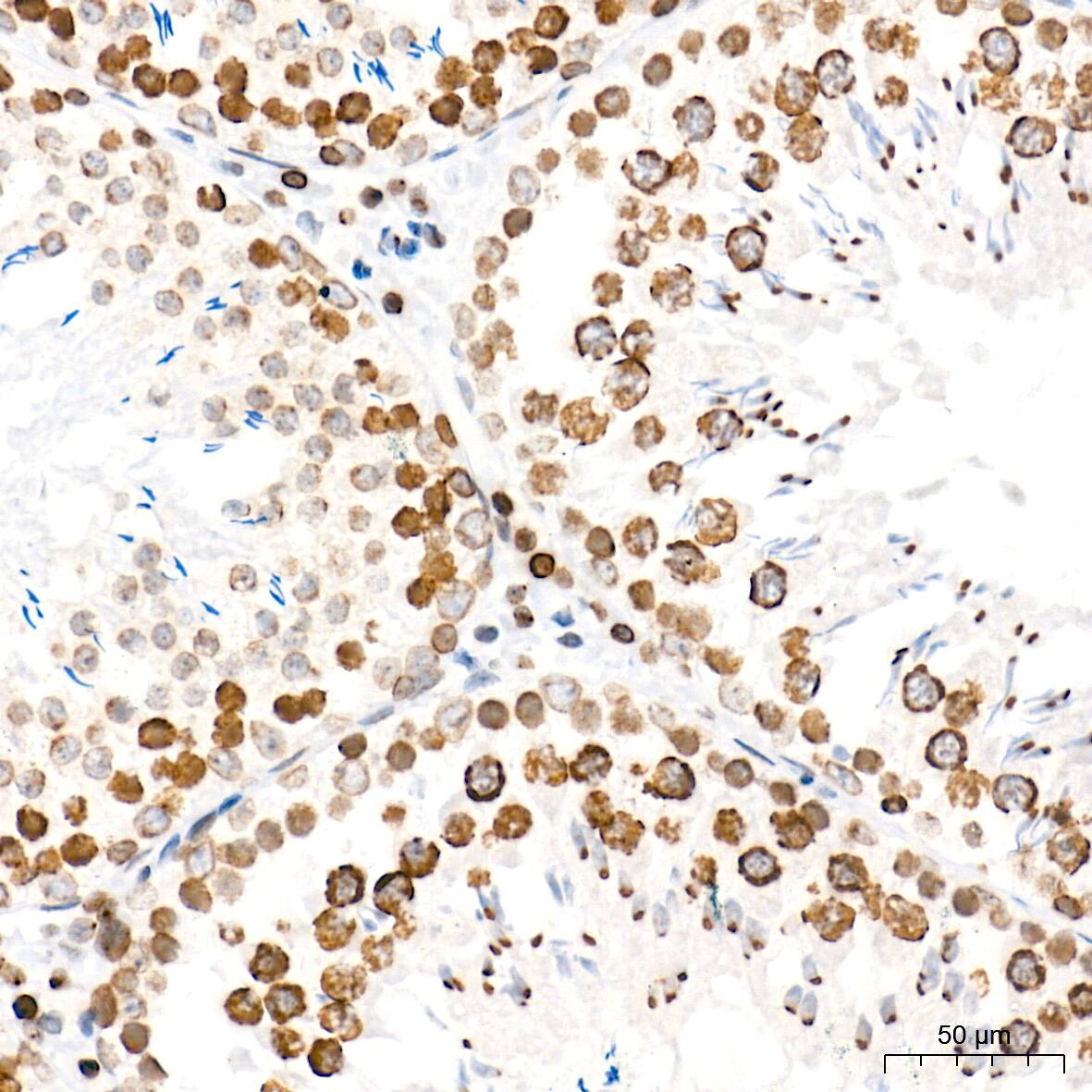 BANF1 Antibody (6J8O2)