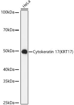 Cytokeratin 17 Antibody (9O6X9)