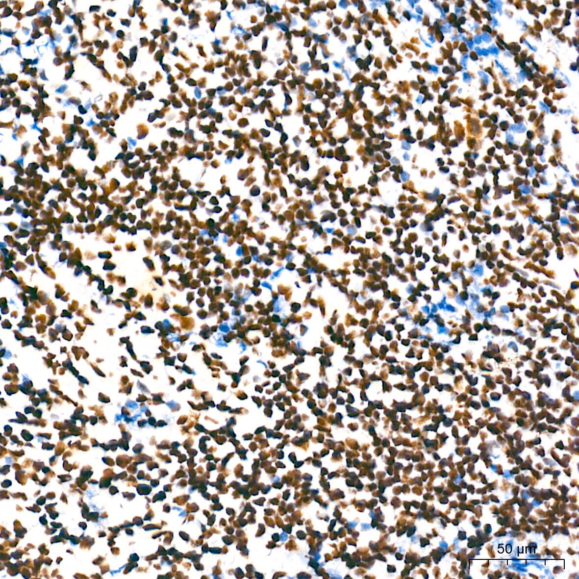 NONO Antibody (0V0N8)