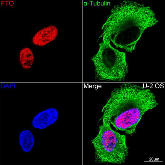 FTO Antibody (2Q9K10)
