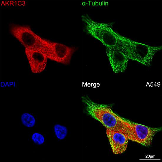 Aldo-keto Reductase 1C3/AKR1C3 Antibody (7T10F5)