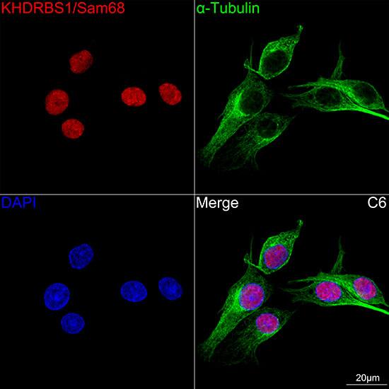 SAM68 Antibody (1O7D1)