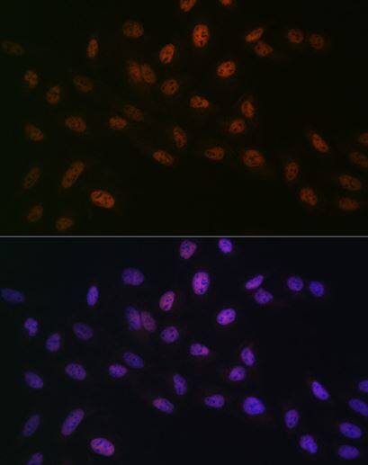 MTA2 Antibody (9A5Y7)