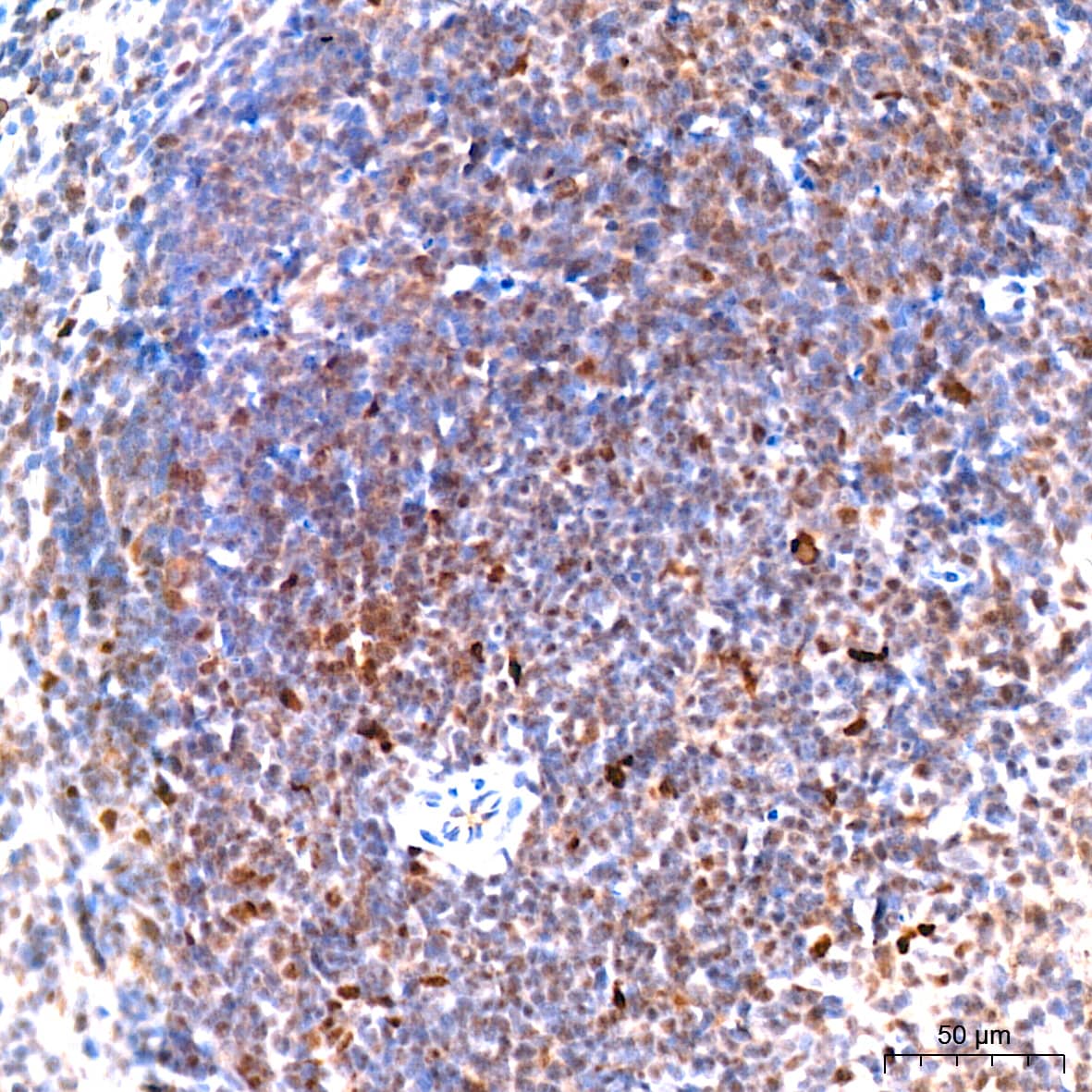 6 Phosphofructo 2 Kinase Antibody (7X10D9)