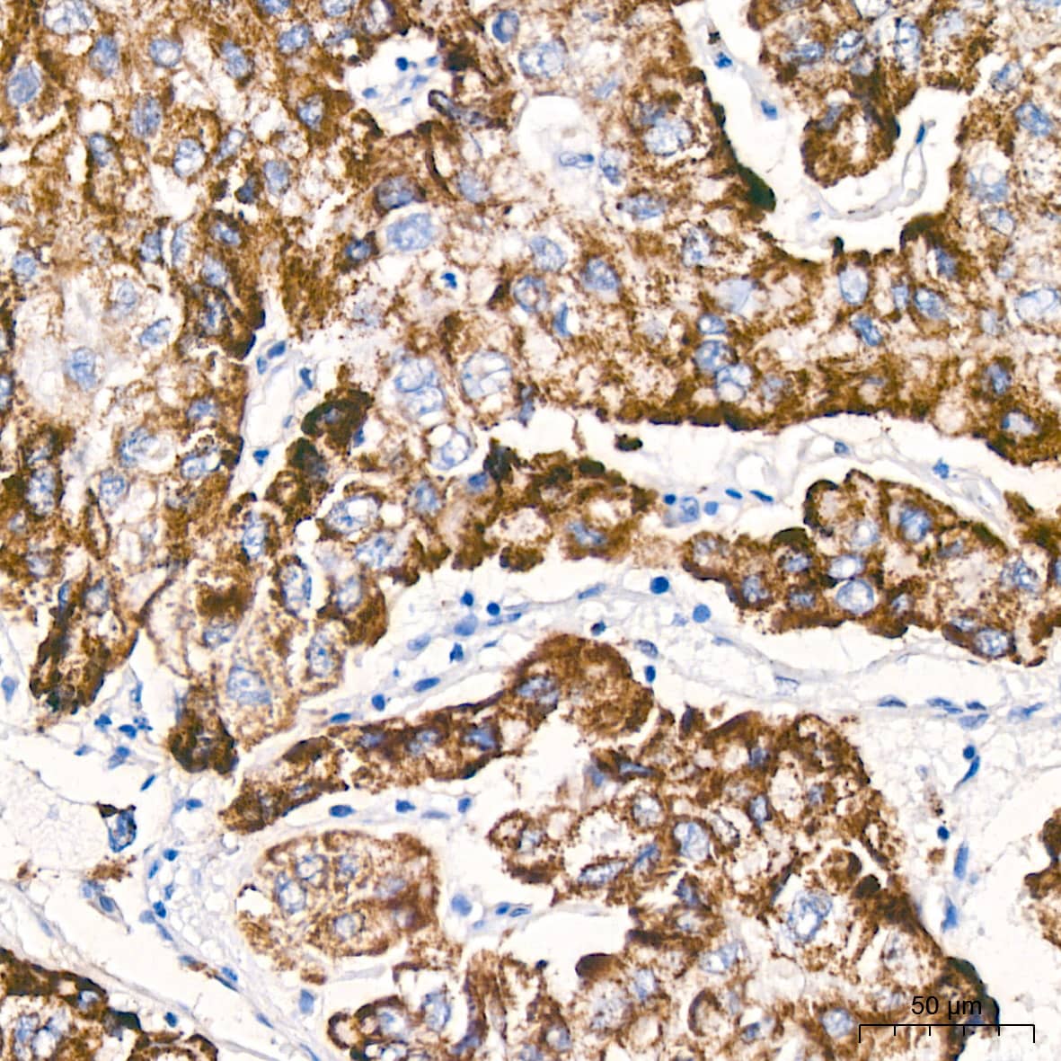 6 Phosphofructo 2 Kinase Antibody (7X10D9)