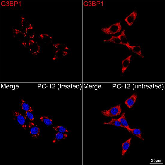 G3BP1 Antibody (5A4T0)