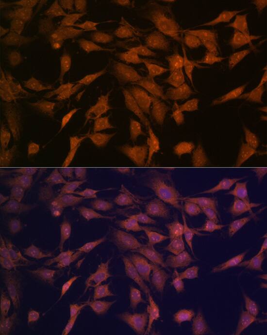 CENPC Antibody (5E3K5)