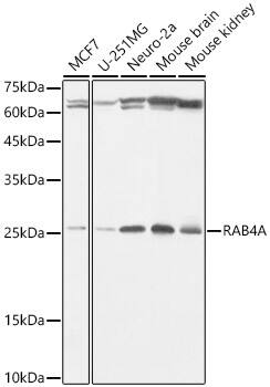 Rab4 Antibody (8I5K1)