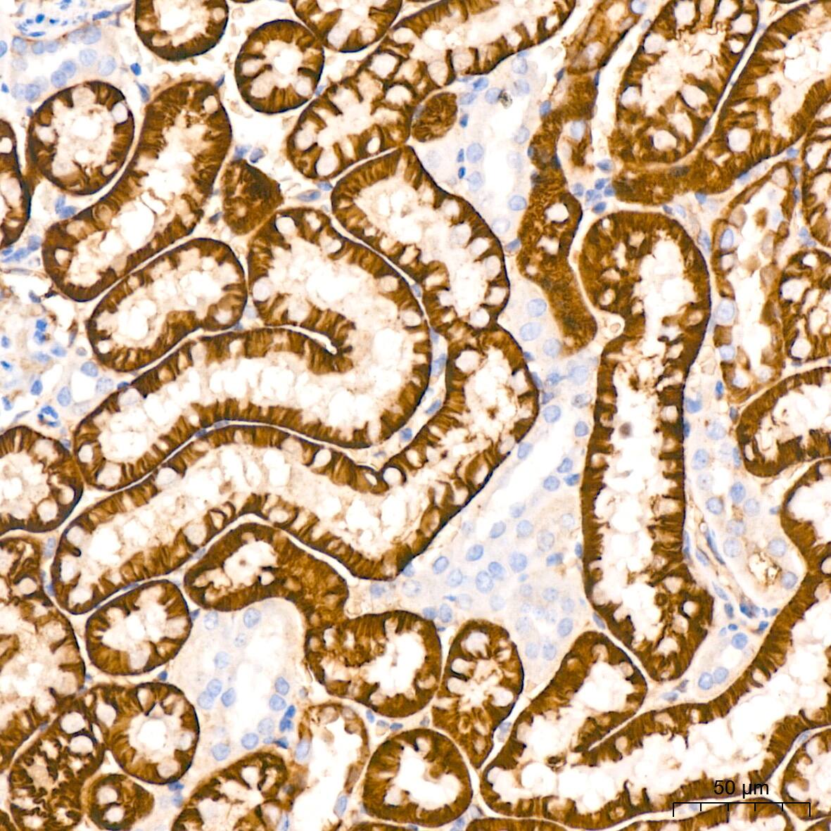 NDRG1 Antibody (2C6K6)