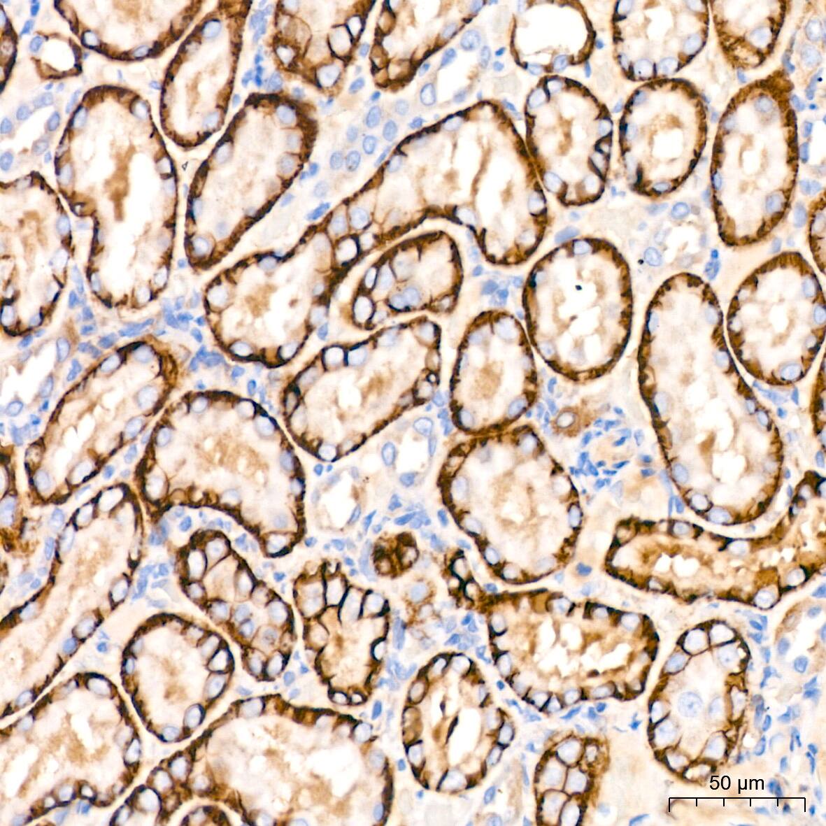 NDRG1 Antibody (2C6K6)