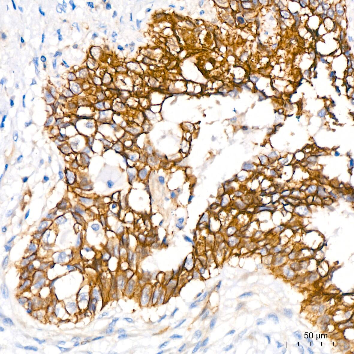 NDRG1 Antibody (2C6K6)