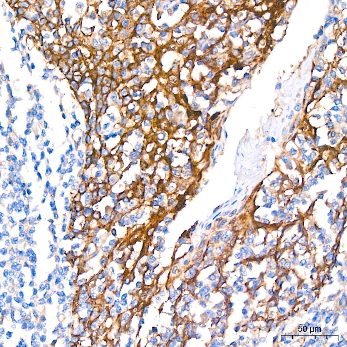 NDRG1 Antibody (2C6K6)