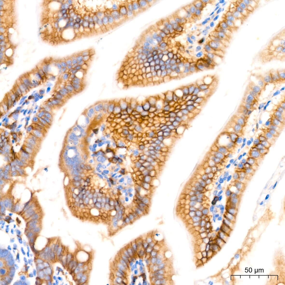 NDRG1 Antibody (2C6K6)