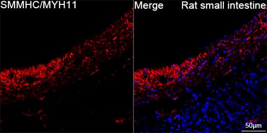 Myosin heavy chain 11 Antibody (0O4O4)