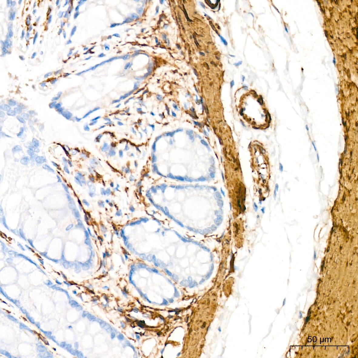 Myosin heavy chain 11 Antibody (0O4O4)